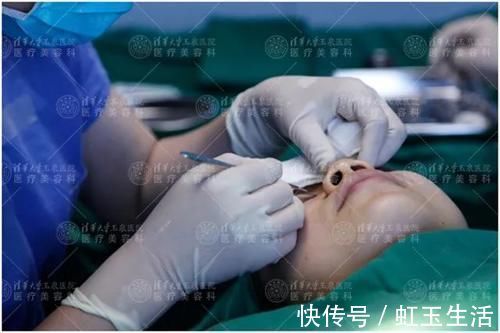 黑眼仁|上睑下垂眼无神，做个双眼皮手术就能搞定吗？