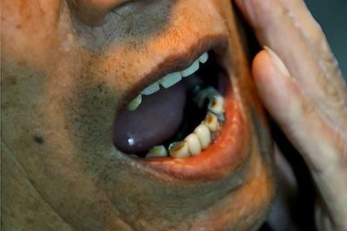 身体|男性身体走“下坡路”时,会有啥表现?50岁后的男性不妨对照下