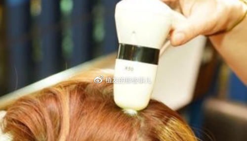 移植 植发科普植发原理?带你揭秘植发手术完整流程