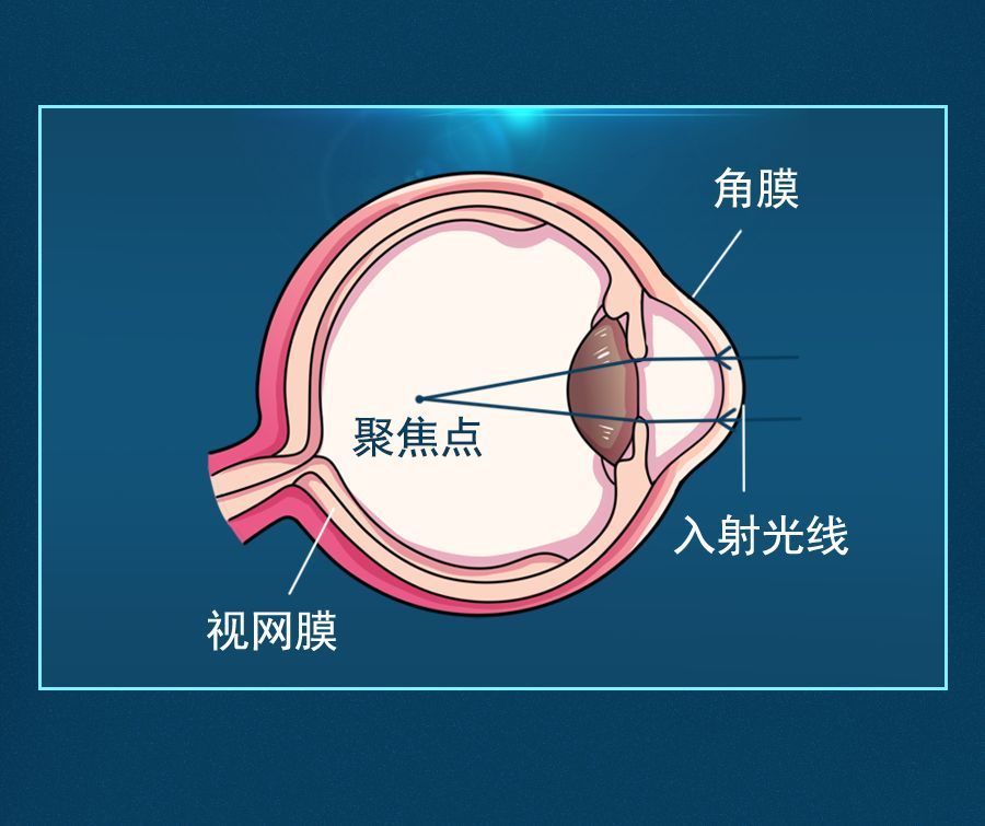 戴眼镜|从小忽略这件事，难怪宝宝3岁戴眼镜