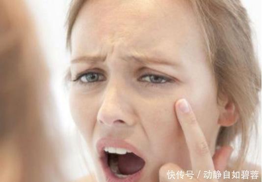 专家提醒:皮肤不好的人,劝你忌口3种食物,否则皱纹只增不减