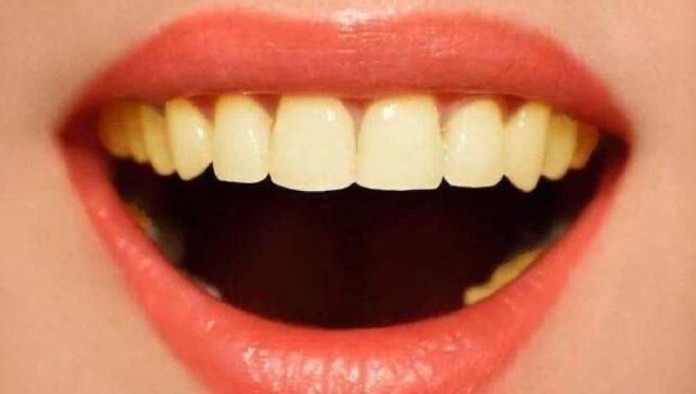 一笑|刷牙时,牙膏要不要“沾水”别不以为然,难怪你一笑一口大黄牙