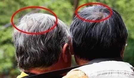 阳明|老中医推荐最有效的白发转黑方,仅2味药材泡水喝,补虚又乌发