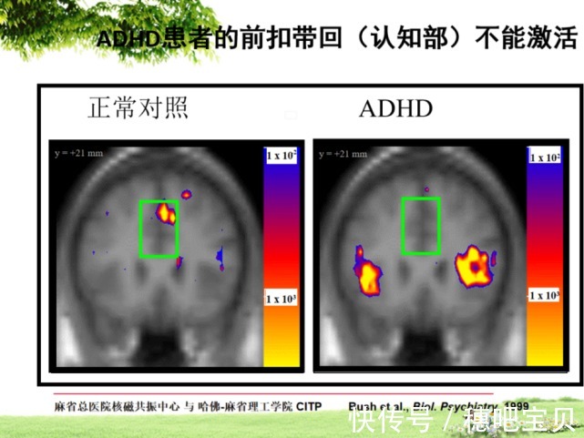 情绪|天使讲堂：孩子不读书，情绪不好，原来是它惹的祸？