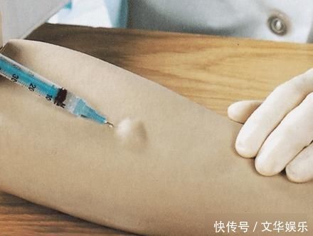 对症治疗|很多人只要一生病,就依赖医生、依赖吃药这个中医外治法值得学