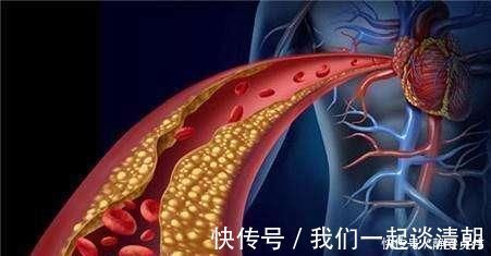 血脂|高血脂“祸根”被揪出，不是肥肉，此物天天吃，血液会“浓如粥”