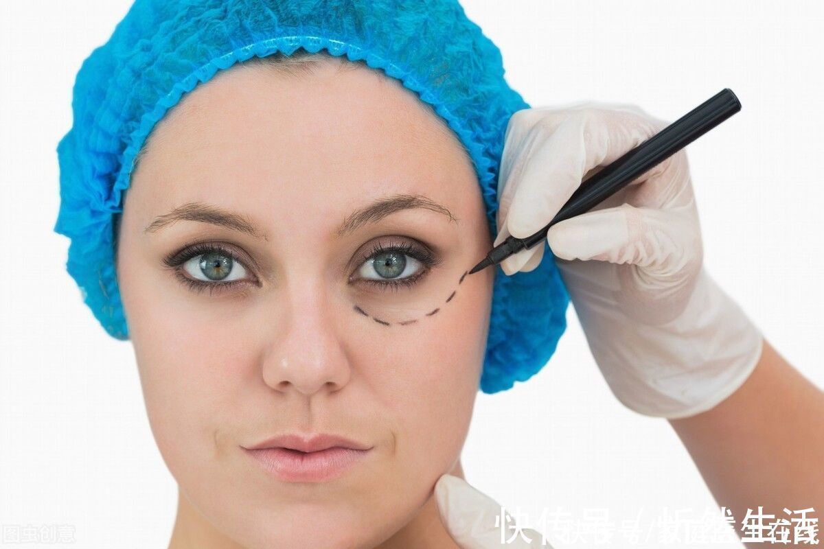 误区 眼部整形术后要多休息,是真的吗?整形医生:错了,多数人总把这些误区当常识