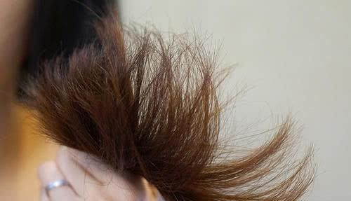 头皮|一天中什么时候洗头发会头疼、掉发？多数人做法不对，要及时纠正