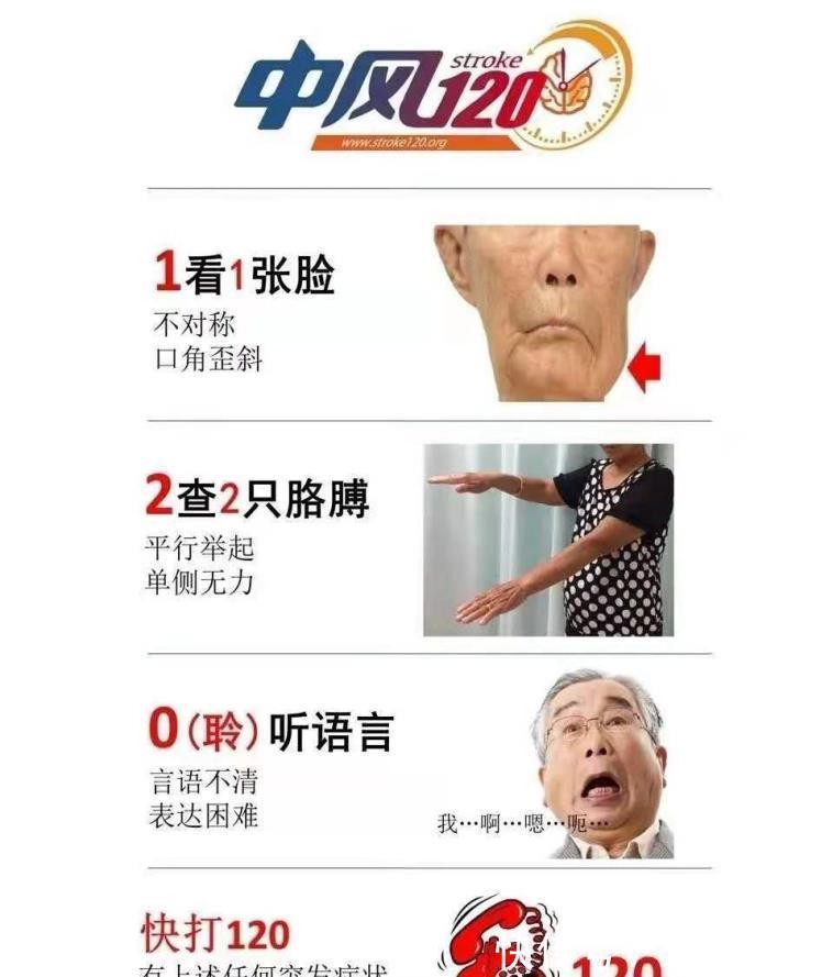 缺血性中风|颈动脉斑块一定会导致脑中风吗？一文带你读懂