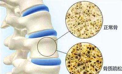菠菜|黄体酮不足的女人,身体或有这5个表现,不妨对照自检一下