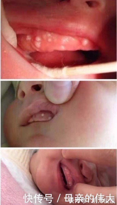 母乳|宝宝出生后新手父母手忙脚乱?有了这份清单,能让你从容面对