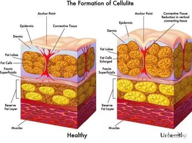 沙漏|38岁身材保持完美,大长腿搭配沙漏身材,保留肌肉是最好的抗衰