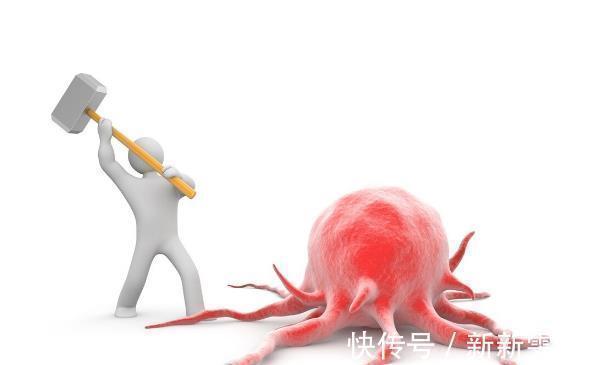 复发|癌症能不能治愈？肿瘤专家：满足这三个条件，就可以