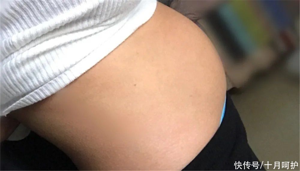 子宫|产后子宫恢复得好不好,看这4个指标