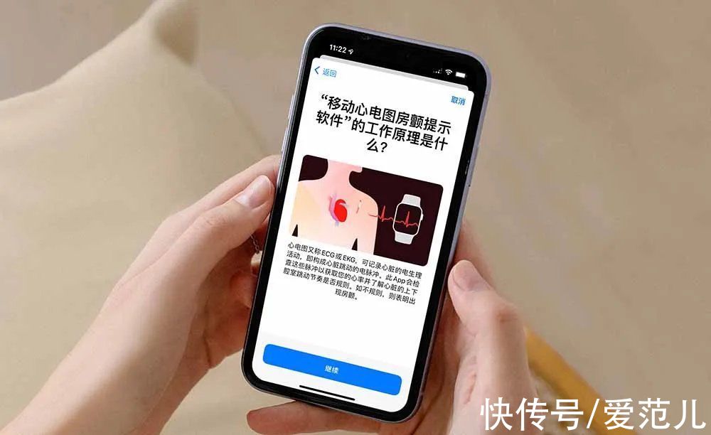 心电图|等了 3 年，国行版 Apple Watch 心电图功能终于来了