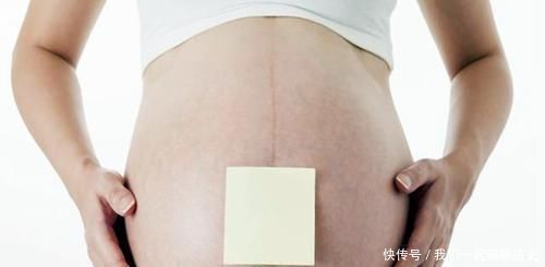 晓芸|怀孕后，孕肚上那条“黑线”能决定生男生女妊娠线功能远不止此
