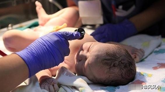 时间点|剖腹产时,若你赶上这个时间点,或许对产妇和宝宝都好!