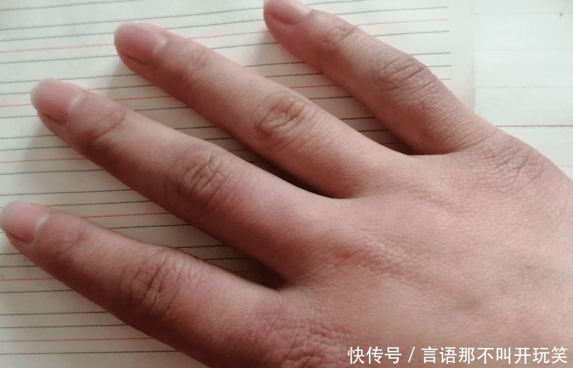 冬天|到了冬天,双手变得干燥怎么办啊?只涂护手霜有用吗?