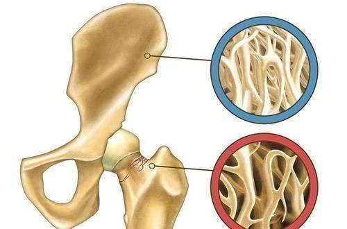 骨骼|茄子是骨质疏松的“发物”?医生:想要养骨,4种食物尽量远离