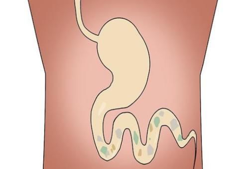 肠道异常,身体会发出4种求救信号!尽早做肠镜,别到晚期再就医