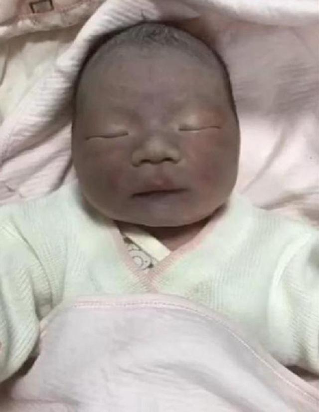 皮肤|国产“黑人宝宝”火了,宝妈生下天生黑皮,宝爸:怀疑生了个矿工