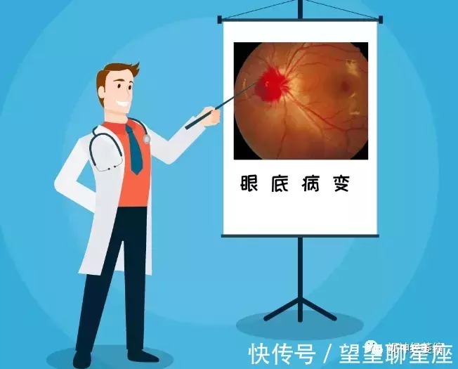 糖尿病|不要忽视糖尿病情况出现的眼底病变