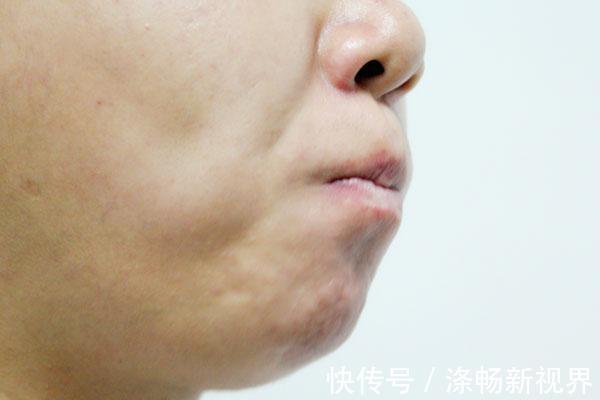 心脑血管|四五块钱一瓶的维生素B2，能治哪些病可惜很多人不当一回事