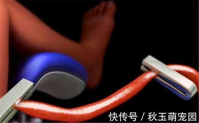 肚子疼!肚脐眼里的“泥”到底是啥?能不能抠?显微镜放大1000倍,真酸爽