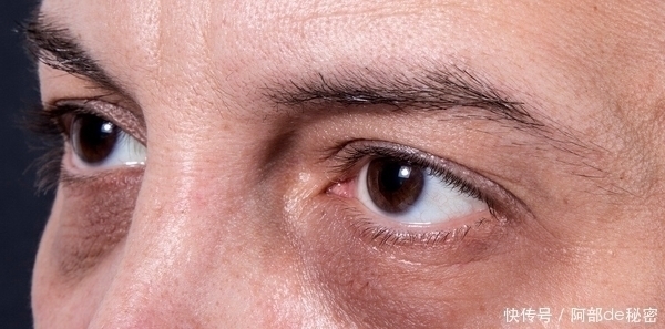 右肩|肝硬化害怕“1种水”,不是枸杞水,平时敞开喝,肝脏干净柔软