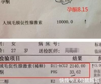 内分泌失调|为何如今女性怀孕普遍孕酮低,是以前不重视还是现在环境不好了?