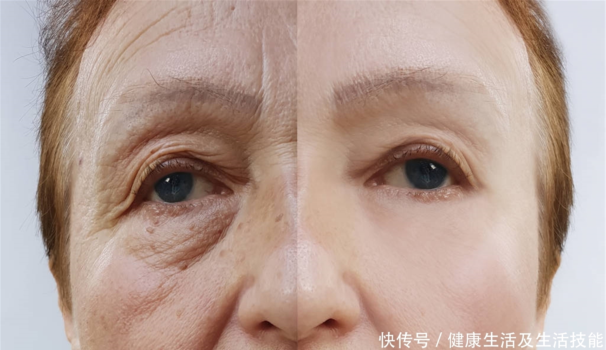 Asian elderly woman face and eye with wrinkles, portrait closeup view ...