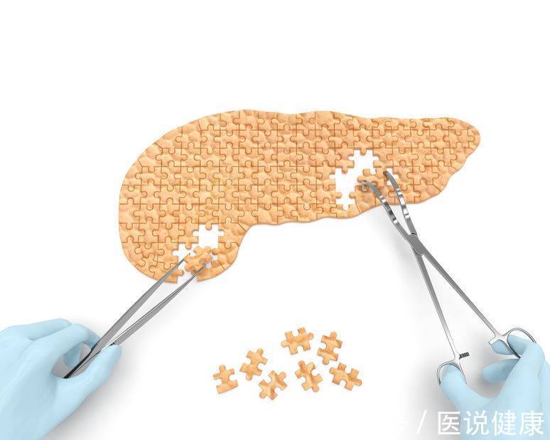 胰腺炎|胰腺癌发生后,身体会发出4个提醒,若你有,要及时检查,不能拖