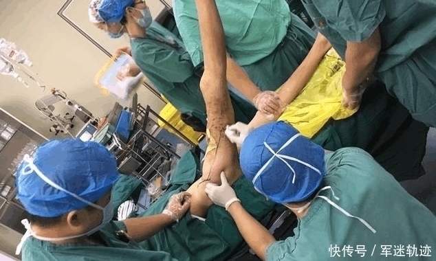 医生们|女孩大腿异常肿痛流血不止, 检查结果连医生都吓了一跳