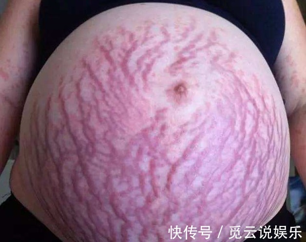 胎儿|怀孕八个月肚子巨大,医院检查一切正常,生产那天丈夫着急了