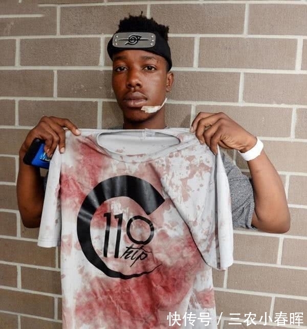 木叶|火影迷回家路上被歹徒袭击,靠鼬神附体反杀,网友:木叶装备牛p