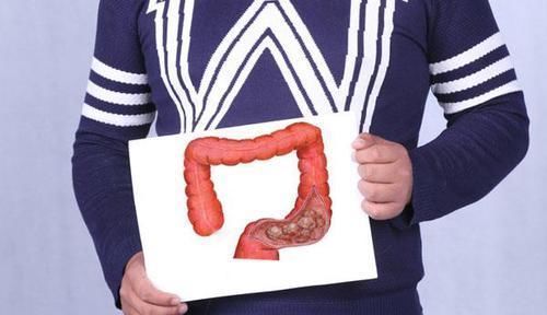 屁多、大便不成形就是肠癌想多了,肠癌的真正信号,别忽视了