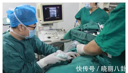 麻醉科|私人医院推广无痛分娩,称“无痛、快速、无后遗症”,真是如此吗