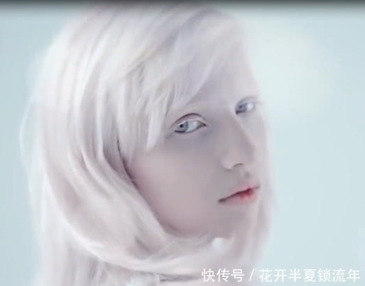 落入凡间|乌克兰美女患白化病，全身一片雪白，宛如天使落凡尘！