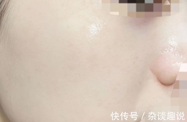 上榜|敏感肌烂脸踩雷排行榜!薇诺娜、珂润上榜!孕妇都能用的修复神器