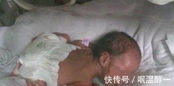 婴儿|女子终于怀孕, 医生却让打掉, 婴儿出生后, 医生直往后退