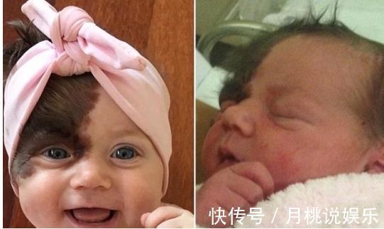 钟无艳|孕期不听劝做了这5件事,将影响宝宝的颜值