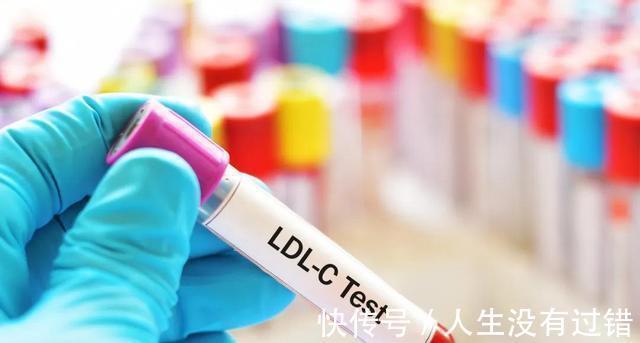 血糖|吃他汀多长时间需要复查一次?该注意点什么?医生告诉你答案