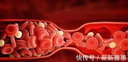 雄性激素分泌|雄性激素分泌多男人，通常有3个共性，如果你也是，偷着高兴吧