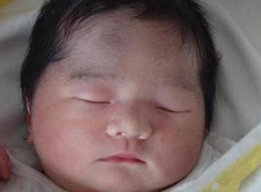 孩子|宝宝出生7天后迟迟不“睁眼”,父母送去医院,医生忍不住笑了