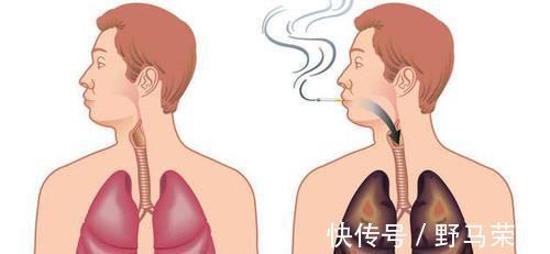 解药|它是尼古丁的天然“解药”,老烟枪常吃, 清肺润肺,肺病不来扰