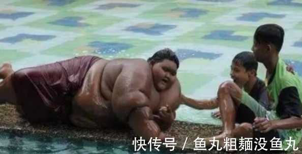 医生|男孩重达400多斤,医生检查后只能活到15岁,怒斥父母无知