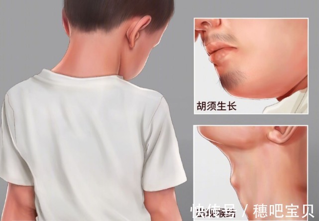 晚长|天使课堂:如何鉴别是晚长还是真矮,主要看这些特征