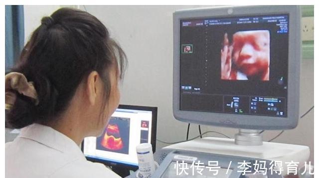 四维彩超|四维彩超不好过?医生:那是你没有提前了解注意事项