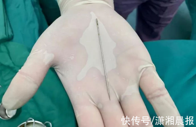 汪俊|9厘米钢针从13岁男孩体内取出!医生:有些教育还是不能少