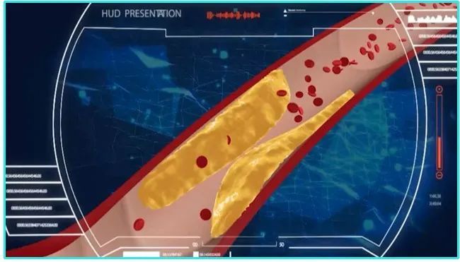降脂药|吃低钠盐吃到心脏骤停?生活中暗藏的这些心血管致命陷阱,你一定要知道!